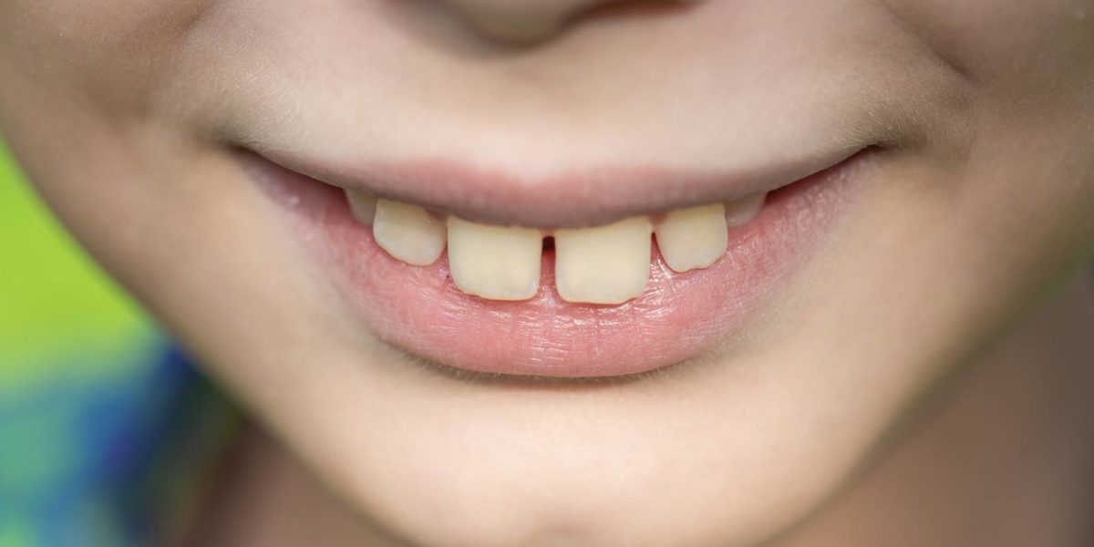 Close-lookup-of-child-teeth