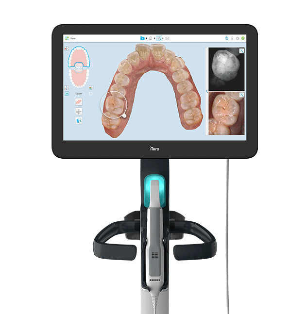 iTero Element® 5D scanner